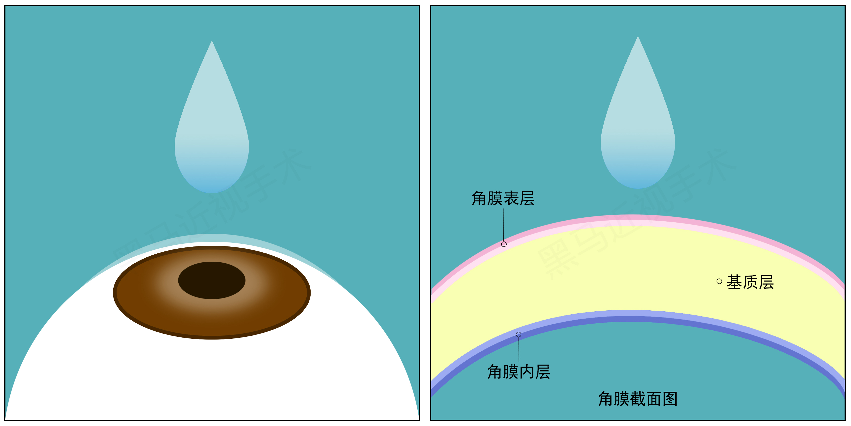 全飞秒步骤一 全飞秒步骤一